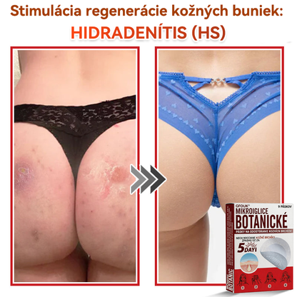 🗽✅GFOUK® MicroNeedle botanic náplasť na odstránenie kožných výrastkov Vyrobené