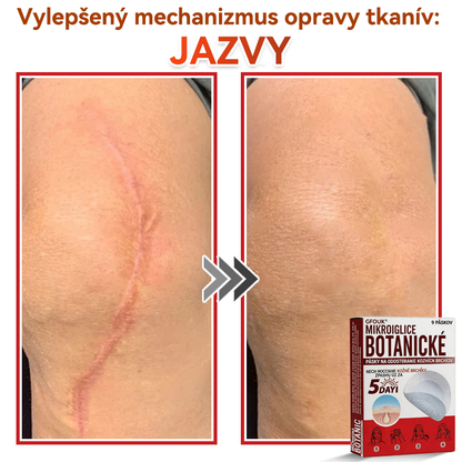 🗽✅GFOUK® MicroNeedle botanic náplasť na odstránenie kožných výrastkov Vyrobené