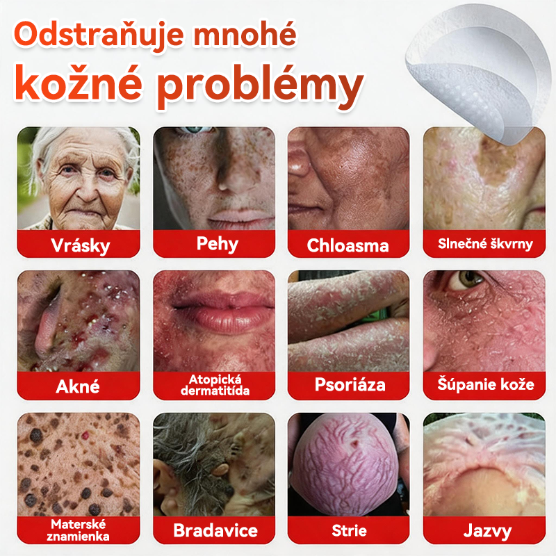 🗽✅GFOUK® MicroNeedle botanic náplasť na odstránenie kožných výrastkov Vyrobené