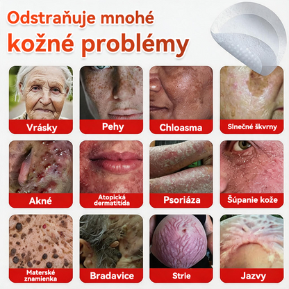 🗽✅GFOUK® MicroNeedle botanic náplasť na odstránenie kožných výrastkov Vyrobené