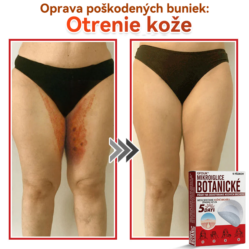 🗽✅GFOUK® MicroNeedle botanic náplasť na odstránenie kožných výrastkov Vyrobené