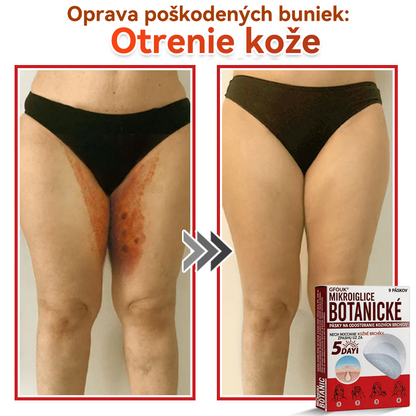 🗽✅GFOUK® MicroNeedle botanic náplasť na odstránenie kožných výrastkov Vyrobené