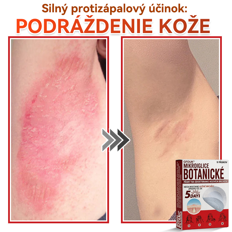 🗽✅GFOUK® MicroNeedle botanic náplasť na odstránenie kožných výrastkov Vyrobené