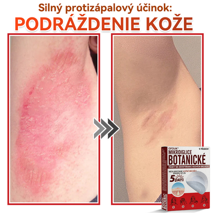 🗽✅GFOUK® MicroNeedle botanic náplasť na odstránenie kožných výrastkov Vyrobené
